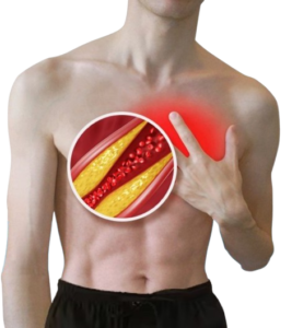 Cholestrol